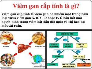 Viem gan cap tinh la gi Nguyen nhan trieu chung va cach dieu tri benh